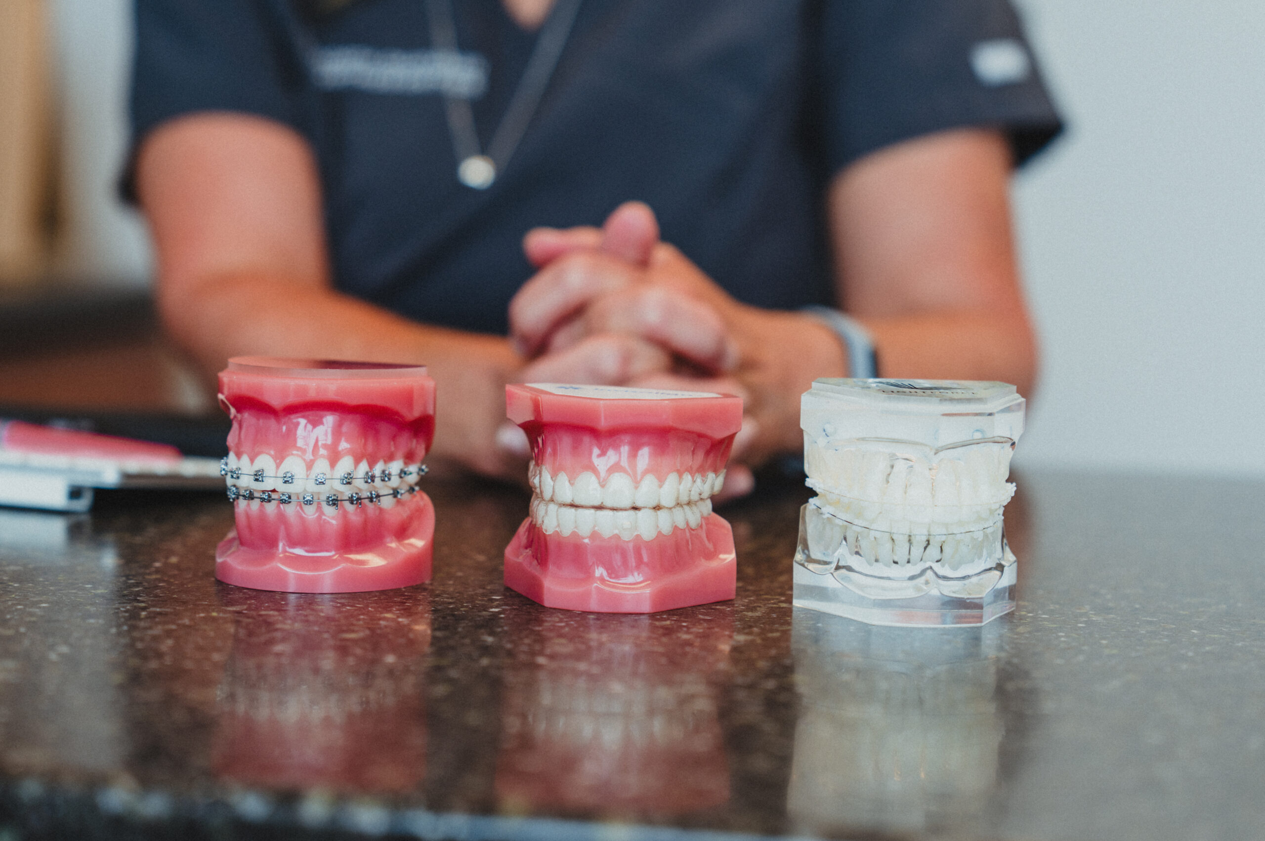 Braces versus Clear Aligners